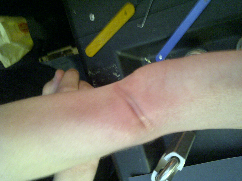 That's going to bruise!